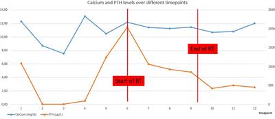 Radiation Treatment for Inoperable Local Relapse of Parathyroid Carcinoma With Symptomatic Hypercalcemia: A Case Report